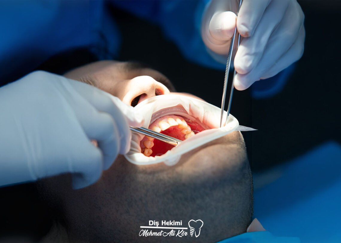 Ağız ve Çene Cerrahisi